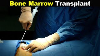 How Does Bone Marrow Transplant Works UrduHindi [upl. by Naut]