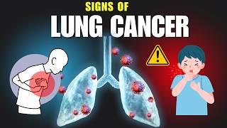 10 Lung Cancer Symptoms I Wish I Knew Sooner [upl. by Pen]