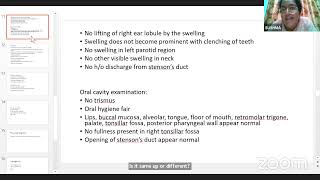 PG CLINICS CARCINOMA BREAST PAROTID TUMOUR [upl. by Nnybor]