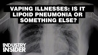 Industry Insider Vaping Illnesses  Is It Lipoid Pneumonia Or Something Else [upl. by Zahavi]