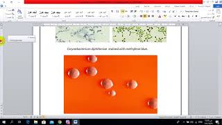 Nonsporeforming Gram positive Bacteria [upl. by Aihsekel874]