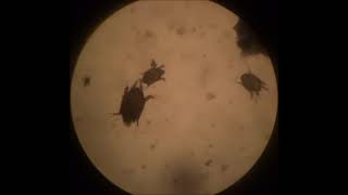 ear mites under microscope [upl. by Hsac]