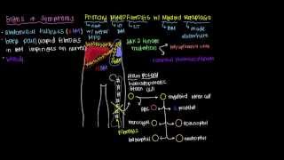 What is primary myelofibrosis [upl. by Ithsav478]