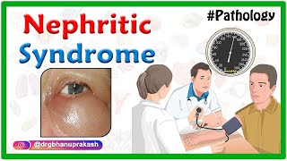 Overview of Nephritic Syndrome  Nephrotic vs Nephritic Syndrome  USMLE Step 1 [upl. by Philo]