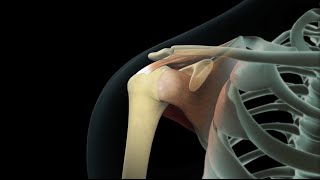 Rotator Cuff Shoulder Surgery [upl. by Nauqyaj]