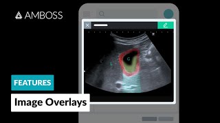 AMBOSS Features Overlay [upl. by Pascal]