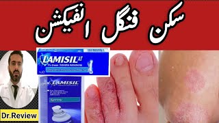 skin fungal infections treatment  Lamisil spray  lamisil cream uses Best Fungal Infection cream [upl. by Nylatsyrc178]