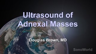 quotUltrasound of Adnexal Massesquot Ultrasound SonoWorld Lecture [upl. by Xuaeb]