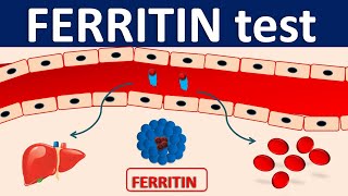 Serum Ferritin test  Its role in inflammation [upl. by Euqnom]