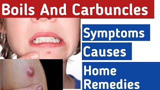 Boils and Carbuncles What causes boils on your body Boils on body home treatment [upl. by Neevan]