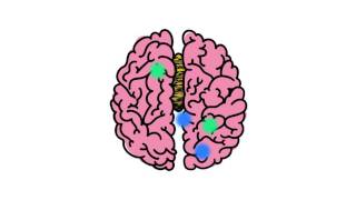 Understanding Disorders of the Corpus Callosum Animated Video by NODCC [upl. by Fanchette]