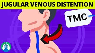 What are the Causes of Jugular Venous Distention JVD  TMC Practice Question [upl. by Ocsic126]