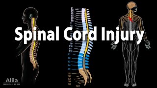 Spinal Cord Injury Animation [upl. by Sum]