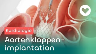 TAVI TranskatheterAortenklappenimplantation  Hightech in der Medizin [upl. by Godber]