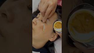 Pigmentation solution free at home shorts pigmentation skincondition diy viral youtube [upl. by Nylirem604]