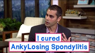 I cured my Ankylosing Spondylitis [upl. by Llerehc]