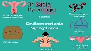 endometriosis symptoms causes amp treatment [upl. by Marcelle]