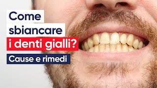 Come sbiancare i denti gialli Cause e rimedi [upl. by Cattan]