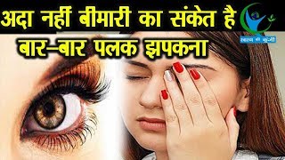 मुश्किल का संकेत हो सकता है बारबार पलक झपकना जानें इसके बारें में Reason for Eye Blink [upl. by Aicala]