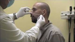 Procedure for Nasopharyngeal Swabs and Aspirates [upl. by Rainer]