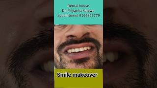 Smile makeover jaipur bestcosmeticdentalclinic dentist viralshort smiledental [upl. by Shuman]