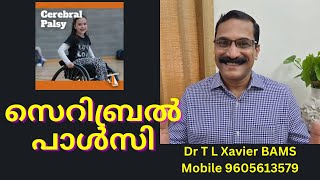 മസ്‌തിഷ്‌ക്ക രോഗം വളർച്ചക്കുറവ്  Shocking Ways Ayurveda Can Help Manage Cerebral Palsy [upl. by Aihsenrad953]