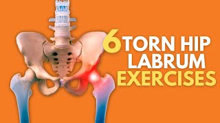 Top 6 Exercises For Naturally Healing A Painful Torn Hip Labrum [upl. by Delaine]