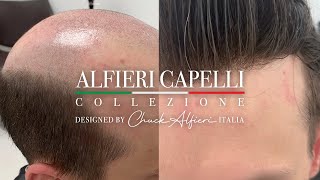 Chuck Alfieri Capelli Hair Replacement Men 032024 [upl. by Forkey]