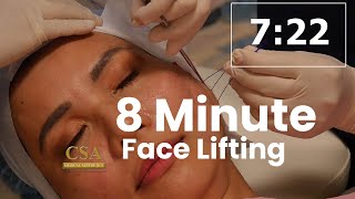 8Minute Face Lifting using COG threads [upl. by Anavrin]