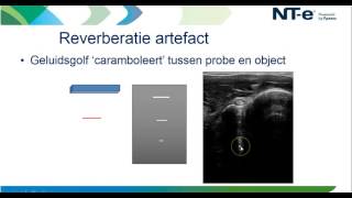 Webinar  Beeldfouten en artefacten in de echografie [upl. by Niwdla]