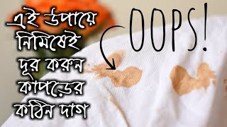 এই সহজ উপায়ে দূর করুন কাপড়ের কঠিন দাগ  how to remove clothes stain  kapore dag tolar upay [upl. by Euqinimod949]