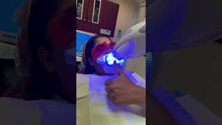 Professional Teeth Whitening Process 🦷✨ dentist teethwhitening teeth selfcare shortsfeed [upl. by Attekal545]