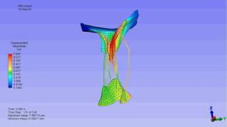 Finite element model of a mitral valve [upl. by Alian]