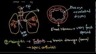 Haemophilus influenzae infection [upl. by Yanad]