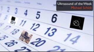 Ultrasound of the Week  Parotitis [upl. by Ahsropal700]