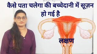 बच्चेदानी में सूज़न के लक्षणBulky Uterus Symptoms [upl. by Bird]