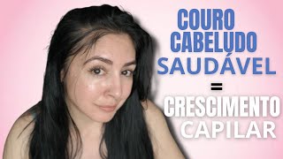 CRESCIMENTO CAPILAR  O MELHOR PRODUTO para COURO CABELUDO  VITAMINA D P O CABELO [upl. by Aisset925]