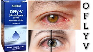 ofly v eye drop uses in urdu Hindi👁️ [upl. by Arac66]