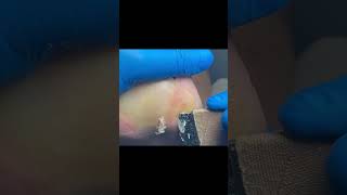 Charming Pedicure Video  Remove Dead Skin [upl. by Hochman]