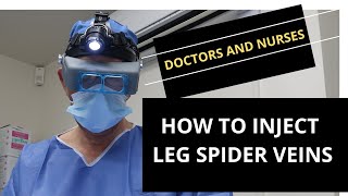 Microsclerotherapy Guide for HealthCare Professionals How to Inject Leg Spider Veins [upl. by Notslar]