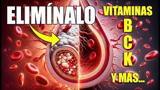 Elimina la PLACAS de CALCIO de tus ARTÉRIAS con estas VITAMINAS [upl. by Annocahs]