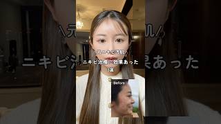 まずは原因特定！！美容整形美容整形肌管理韓国美容スキンケアコスメ垢抜け [upl. by Einnor]