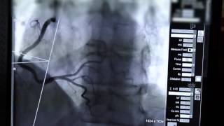 A Stent in Time Saves Lives [upl. by Anais]