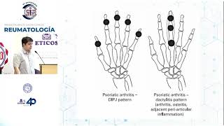 Presentación de casos Clínicos Reumatología [upl. by Intyre]