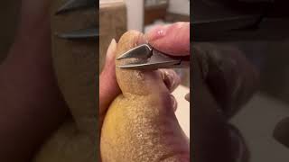 ASMR Toe Maintenance Clipping with Hyperkeratosis EPPK foot callus Keratoderma  May 23 2023 [upl. by Justin]