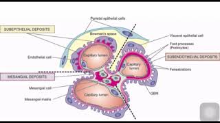 GLOMERULAR DEPOSITS [upl. by Arrad105]