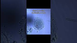 In Vitro Fertilization Is Natural Conception Impossible [upl. by Rossi425]