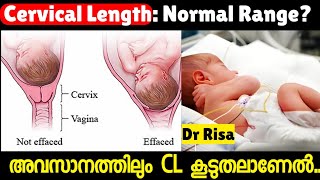 നേരത്തെയുള്ള പ്രസവ സാധ്യതക്ക് കാരണമാകുന്ന CERVICAL LENGTH 9 month Pregnancy [upl. by Latsyrk793]