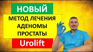 Новый метод лечения аденомы простаты  UROLIFTуролифт [upl. by Brosy969]