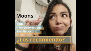 Terminé mi tratamiento de MOONS 🌛  ¿LOS RECOMIENDO  Alineadores invisibles [upl. by Attenej]